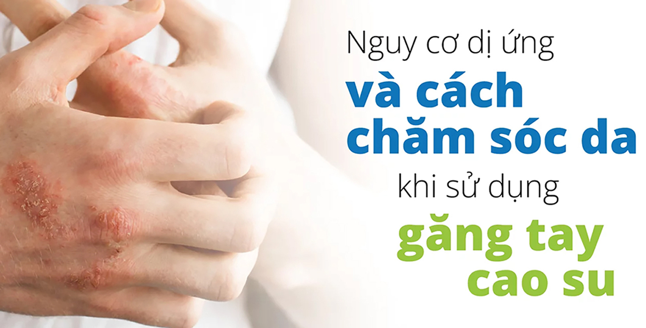 Nguy cơ dị ứng và cách chăm sóc da khi đeo găng tay cao su