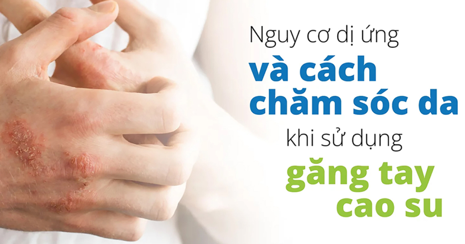 Nguy cơ dị ứng và cách chăm sóc da khi đeo găng tay cao su